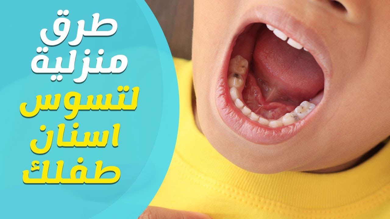 تسوس الأسنان بسبب الرضاعة وكيف تمنع هذا التسوس