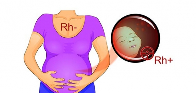 ما تأثير الأجسام المضادة أو الرايزيسي على الحمل