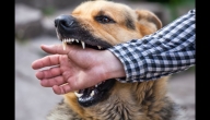 تعرف على علاج عضة الكلب بخلطات طبيعية قبل المساعدة الطبية