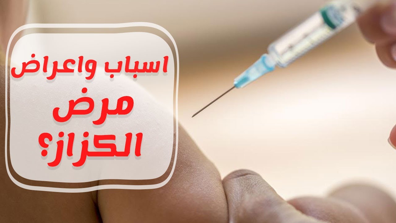 طرق الوقاية من مرض الكزاز وما هي أعراضه