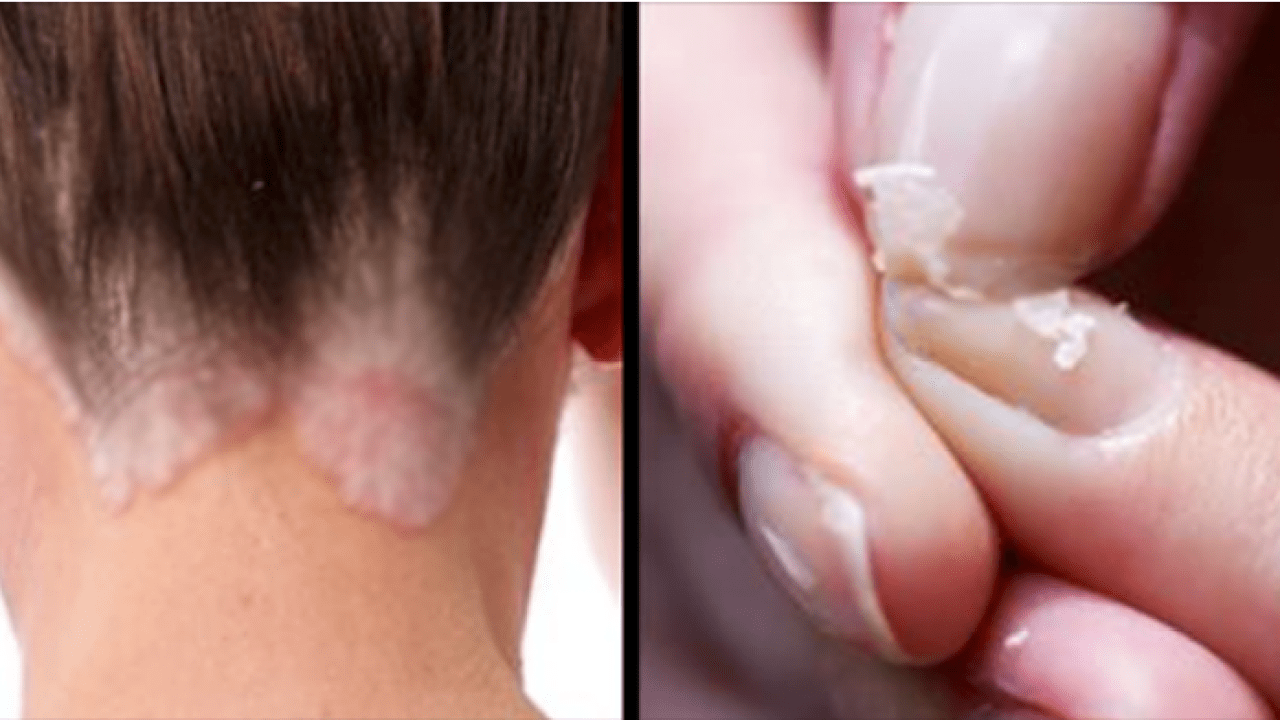 كيف تتعامل مع جفاف الجلد تعرف على أهم التفاصيل