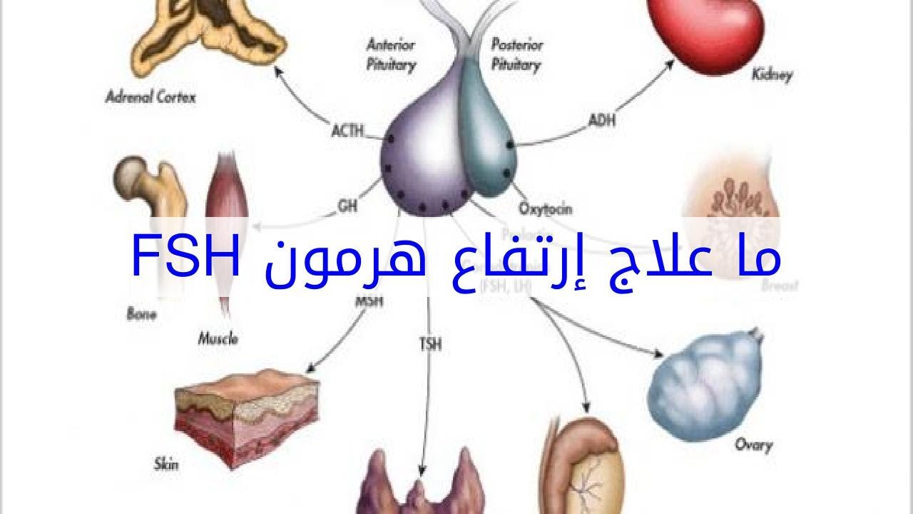 ما هو هرمون المنبه (هرمونFSH)