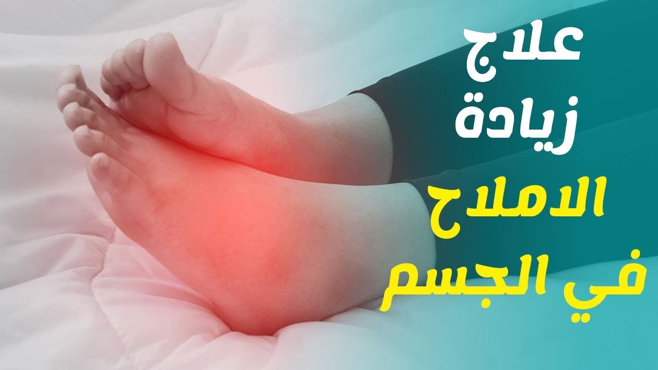 ماهي أعراض وجود الأملاح في الجسم وكيف يتم علاجها