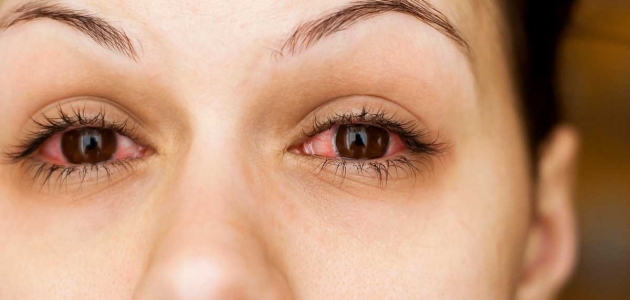 الأمراض التي تتعرض لها العين وطرق الحفاظ عليها من الإلتهابات