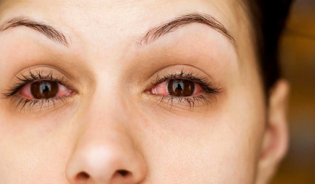 الأمراض التي تتعرض لها العين وطرق الحفاظ عليها من الإلتهابات