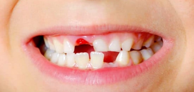 تعرف على أهمية وجود الأسنان اللبنية عند الأطفال