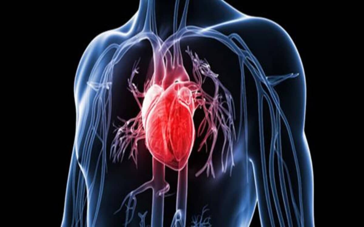 تمدد الأوعية الدموية حالات خطيرة تصيب القلب والدماغ