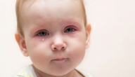 علامات تظهر على طفلك تؤكد وجود مشكلات في العين
