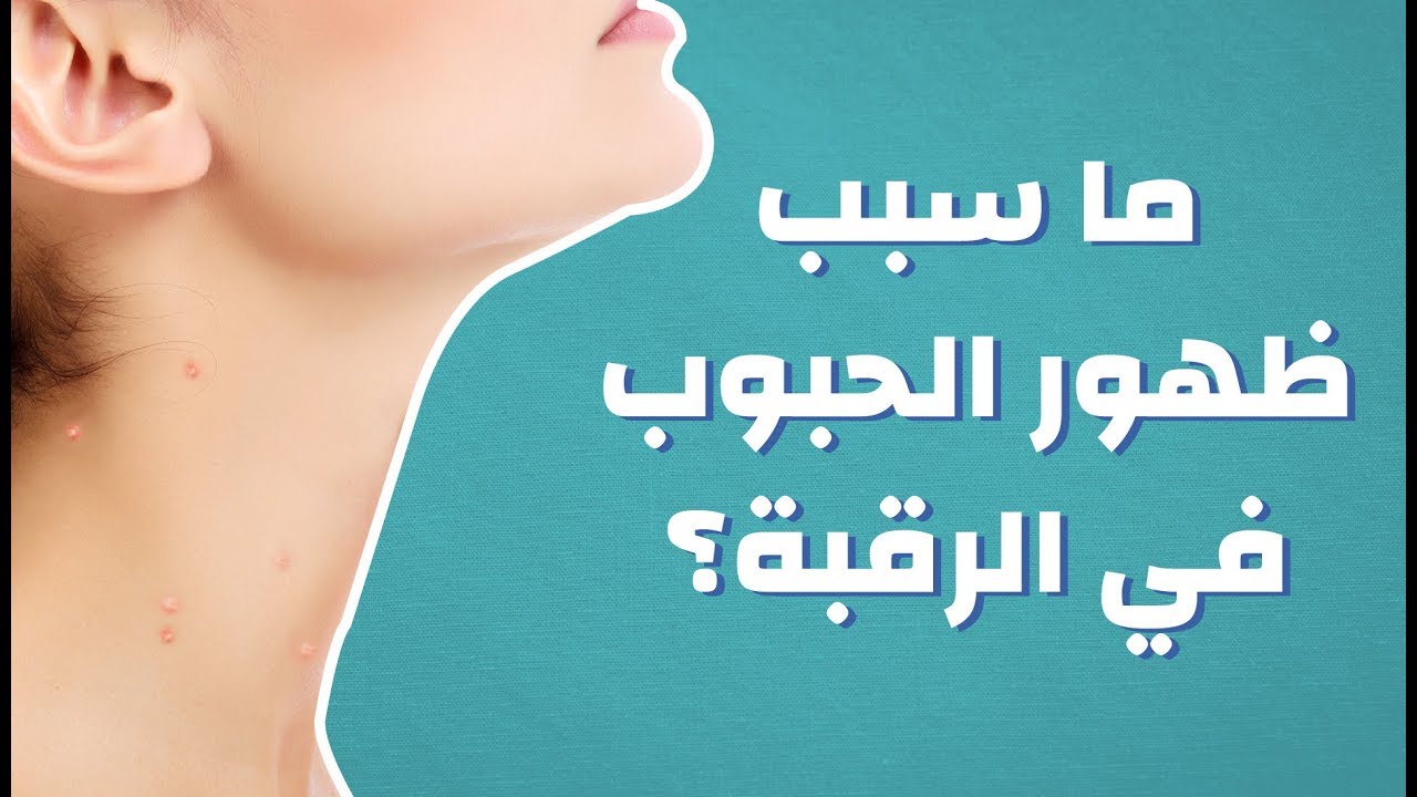 لماذا تظهر على الرقبة حبوب وكيف يمكن علاجها