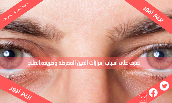 تعرف على أسباب إفرازات العين المفرطة وطريقة العلاج