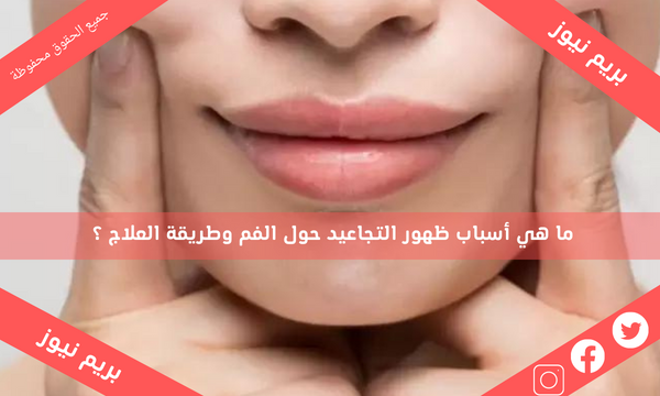 ما هي أسباب ظهور التجاعيد حول الفم وطريقة العلاج ؟