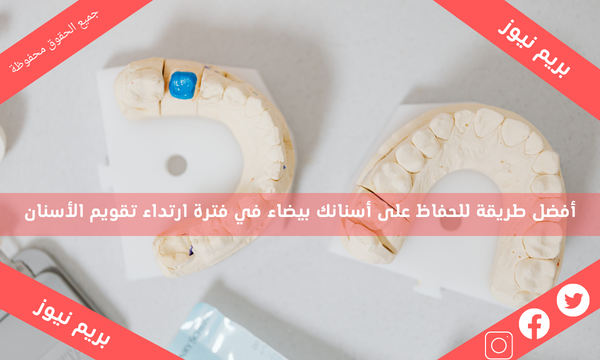 أفضل طريقة للحفاظ على أسنانك بيضاء في فترة ارتداء تقويم الأسنان