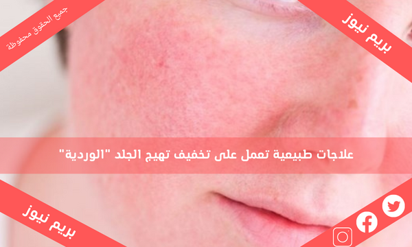 علاجات طبيعية تعمل على تخفيف تهيج الجلد “الوردية”