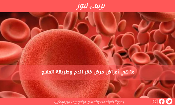 ما هي أعراض مرض فقر الدم وطريقة العلاج
